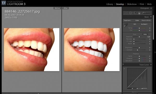 Отбеливание зубов в Lightroom Отбеливание зубов в Lightroom